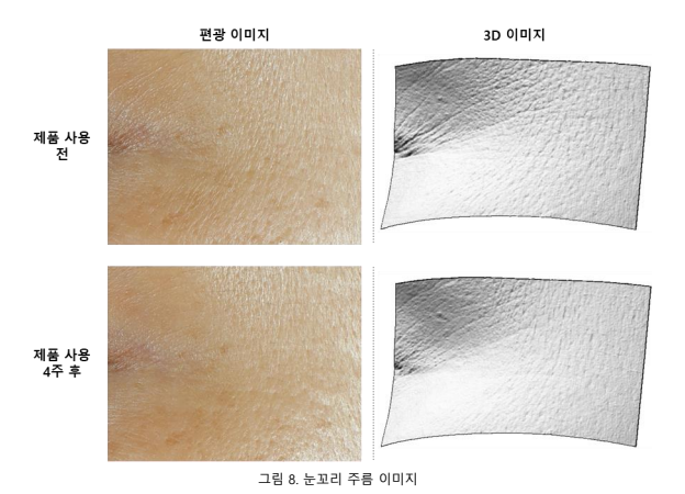 제품 사용 전과 제품 사용 4주 후의 눈꼬리 주름 이미지