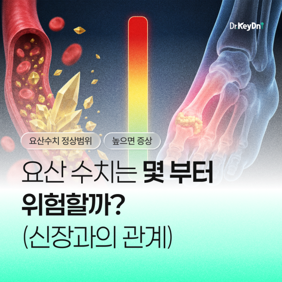 요산 정상 수치는 얼마일까?_썸네일