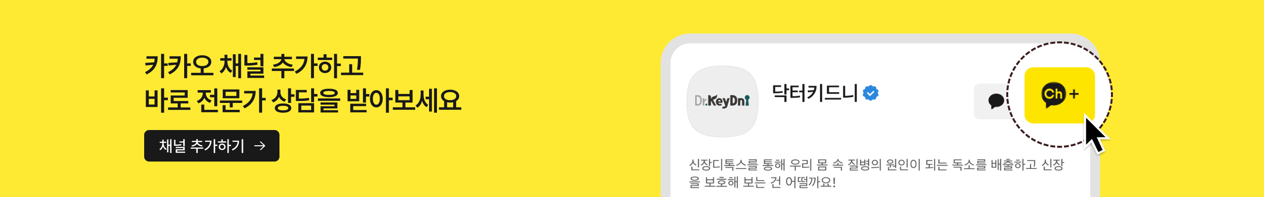자유배너